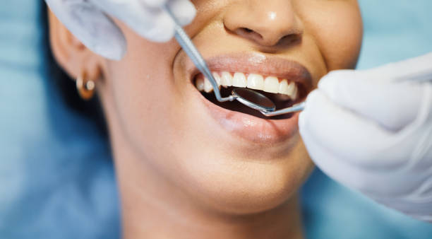 Best Walk-In Emergency Dentist in Wetherington, OH